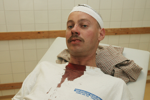 Rvsz Mriusz fideszes kpvisel is megsrlt
// Fot: Huszti Istvn, (c) 1999-2025 Index.hu